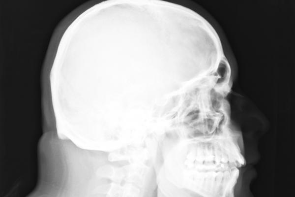 Zsombor fő munka-helye oldalnézetben. Pólya Zsombor 2.